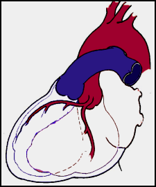 Cœur normal. Le sang veineux (bleu) est explusé dans les poumons, le sang artériel (rouge) dans l’organisme.